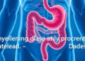 $4 Million NIH Grant Targets Lingering Gut Symptoms When Colitis Inflammation Fades