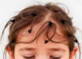 Pandemic-Era Functional Tics Differ Sharply From Tourette Syndrome, Systematic Review Finds