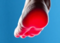 Single-Cell Sequencing Reveals Why Diabetic Foot Ulcers Refuse to Heal