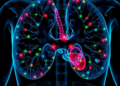 Whole-genome scan of 1,001 prostate cancers reveals hidden drivers and four risk oncotypes