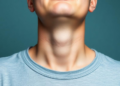 Neck Circumference May Signal Hidden Metabolic Risk in People with Obesity