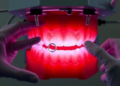 From Digital Workflows to Robotic Surgery: How Oral Implantology Is Being Transformed