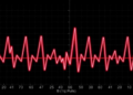 Asymmetric Biphasic Pulses Reshape Atrial Fibrillation Ablation in Landmark Chinese Trial