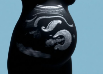3D Placental Ultrasound Models Predict Preeclampsia Weeks Before Symptoms Appear