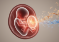 Maternal Stress and Fetal Sex Shape Prenatal microRNA Signals Tied to Children's Anxiety Risk