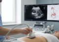 AI Learns to Simulate Abdominal Ultrasound Scans from Simple Anatomical Maps