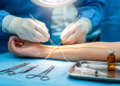 Surgery Plus Vitamin B12 Outperforms Either Alone in Peripheral Nerve Injury Trial
