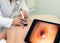 AI Learns to Trust the Right Kind of Skin Photo: Dermoscopy-Dominant Fusion Boosts Lesion Diagnosis