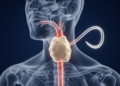 Primary tracheal lymphoepithelioma-like carcinoma in a young non-smoking male: a case report highlighting the diagnostic value of flow-volume loop