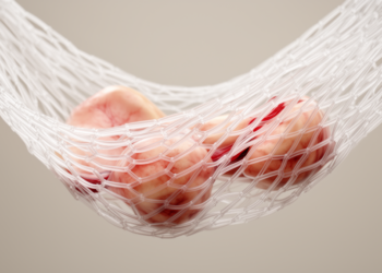 Mesh Hammock Rebuilds the Groin After Radical Cancer Surgery, Keeping Hernias at Bay