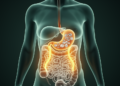 Multi-omic study points to visceral fat as key player in gallstone disease in women with obesity