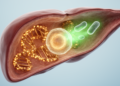 Epigenetics and Metabolism: The Two-Way Conversation Driving Liver Cancer