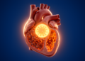 How Broken Body Clocks and Iron-Driven Cell Death May Fuel Hypertension
