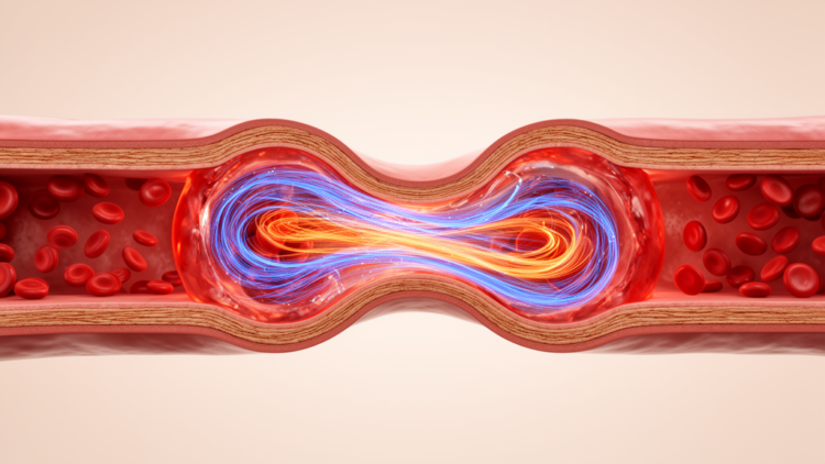 Bernstein polynomials crack the equations of nanofluid blood flow in stenosed arteries