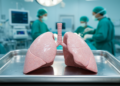 Lungs Take Center Stage in Debate Over Organ Retrieval After Circulatory Death