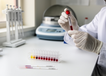 Two Serological Tests Show High Accuracy for Detecting Crimean-Congo Haemorrhagic Fever Virus Exposure in Tanzanian Febrile Patients