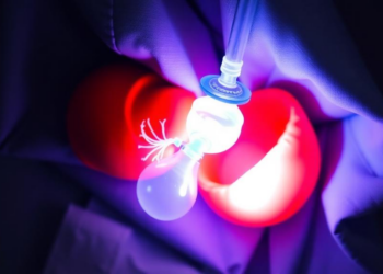 Liver Transplants for Rare Bile Duct Cancer Show Strong Survival in Australia and New Zealand