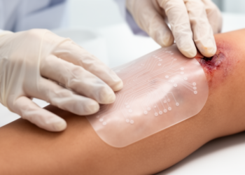 Electric Fields Meet Smart Materials: New Dressings Aim to Heal Chronic Wounds