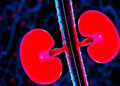 Splicing Factor LUC7L2 Emerges as a Driver of Kidney Damage from Chemotherapy