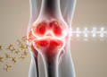 Herbal Compound Casticin Eases Knee Osteoarthritis Inflammation by Blocking FAK/PI3K/AKT Signalling