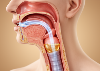 Restoring Airflow Through the Larynx May Rebuild Swallowing After Tracheostomy