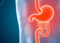 A gentler chemo schedule may match standard care in advanced pancreatic cancer