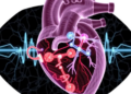 Hidden Heart Pathway Behind Failed Pulsed Field Ablation Revealed in Rare Case