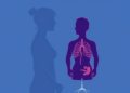 Female Donors Raise Graft-Versus-Host Disease Risk in Male Recipients, Meta-Analysis Confirms