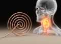 Design and optimization of a multi-band spiral antenna for frequency-dependent hyperthermia heating in head and neck cancer treatment