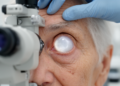 Cataract Clouding in Diabetes Traced to a DNA-Sensing Inflammatory Chain Reaction