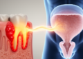 Gum Inflammation May Quietly Weaken the Bladder and Vagina After Menopause