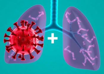 Macrolide Plus Nucleoside Combo Curbs SARS-CoV-2 and Shields Monkey Lungs
