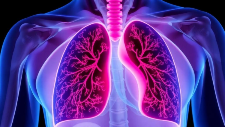 Persistent Emotional Distress Tracks With Poorer Survival in Lung Cancer Patients Undergoing Neoadjuvant Therapy and Surgery