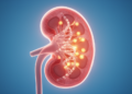 Antioxidant Gene Variants Linked to Kidney Disease in Egyptian Children