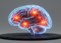 Brain Inflammation and Network Changes Linked to Depression After Herpes Simplex Encephalitis